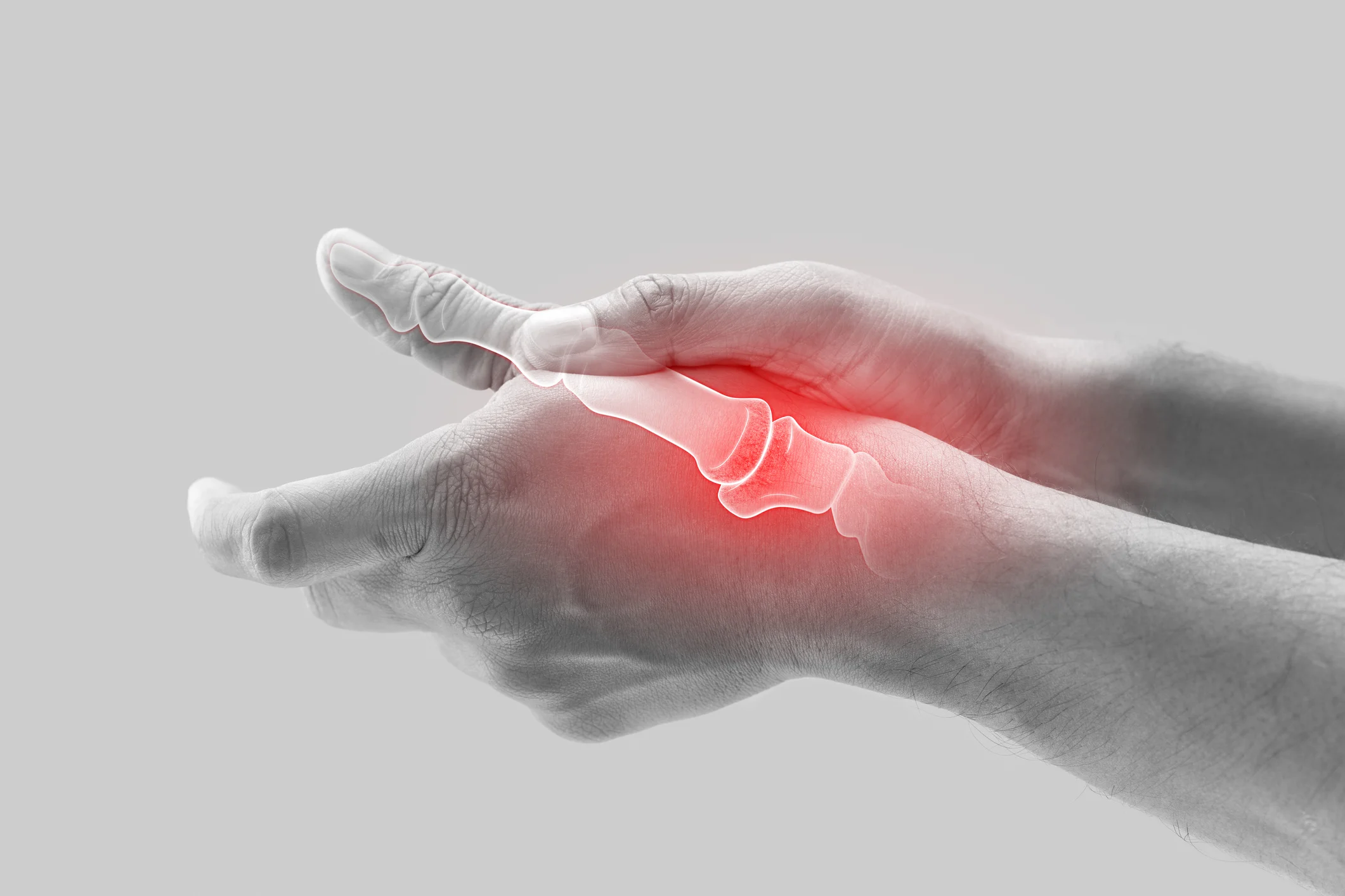Arthritis relief image