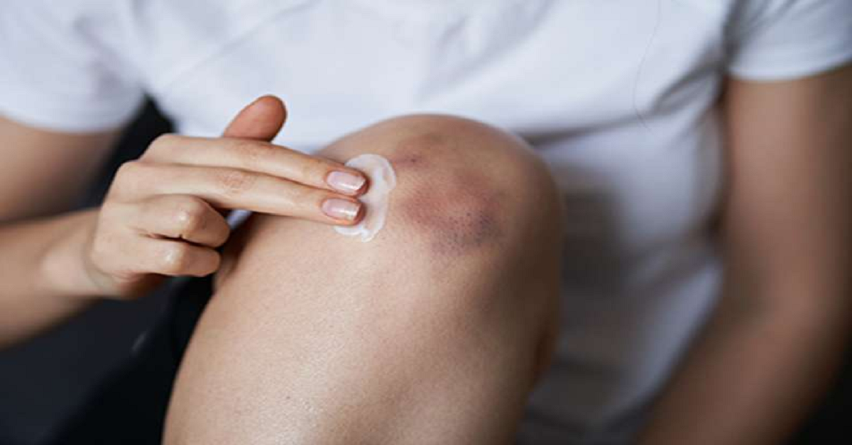 best pain relief cream canada
